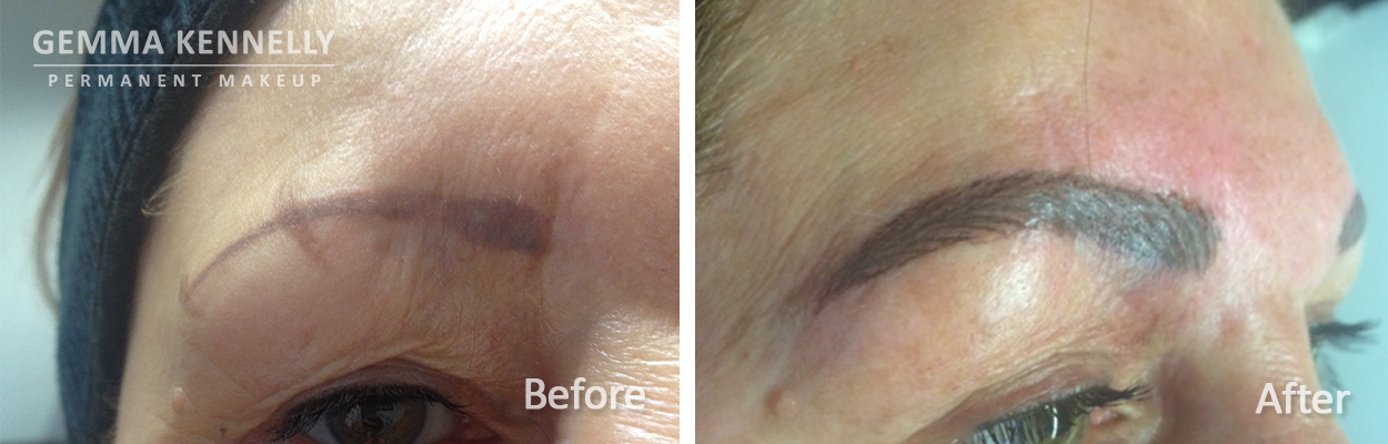 Permanent makeup correction, Wirral